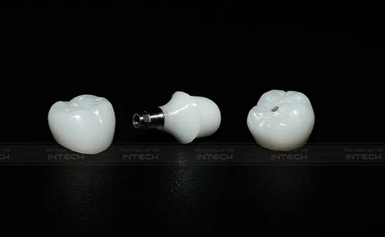 Sai lầm phổ biến khi trồng răng implant