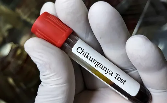 Mỹ phê duyệt vaccine đầu tiên trên thế giới ngừa virus Chikungunya