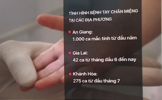 Bệnh chân tay miệng tăng mạnh tại nhiều địa phương