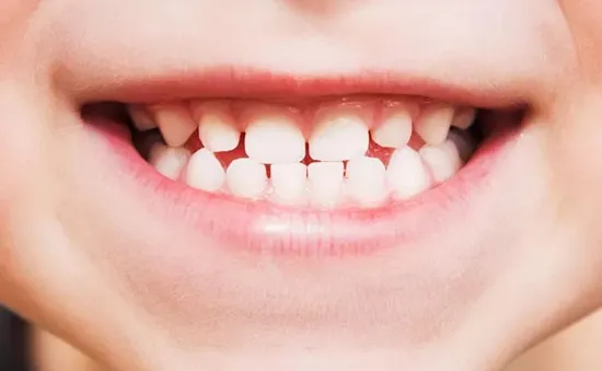 Nhật Bản phát triển thuốc giúp kích thích răng mọc trở lại