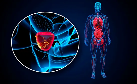 Xu hướng gia tăng mắc ung thư ở tuổi dưới 50