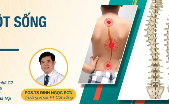 Khám sàng lọc, tư vấn miễn phí gù vẹo cột sống ở trẻ em