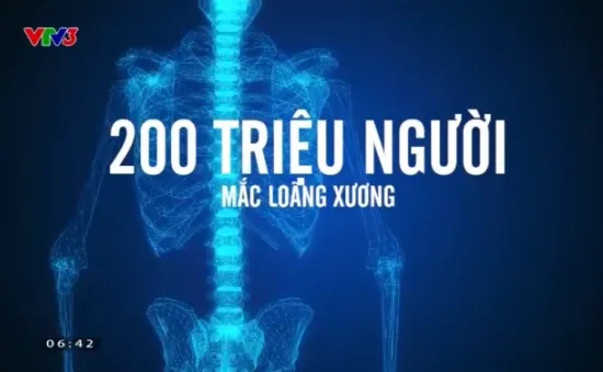 Vì sao phụ nữ trung niên có nguy cơ loãng xương cao