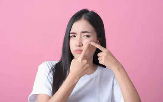 Ăn gì để giảm mụn trứng cá?