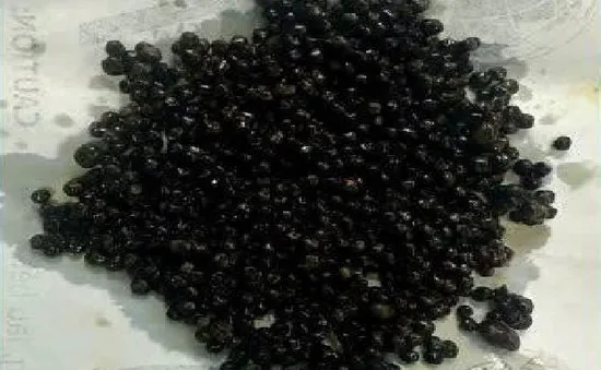 Cắt túi mật chứa hơn 500 viên sỏi cho bệnh nhân