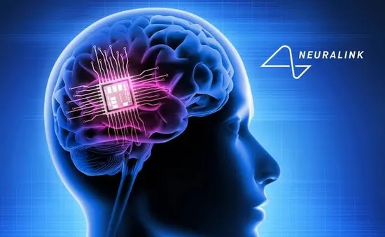Người đầu tiên được cấy chip não của Neuralink giờ ra sao?