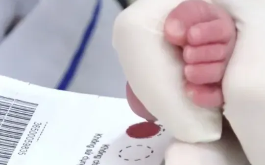 Trẻ sơ sinh phát hiện suy giáp bẩm sinh nhờ sàng lọc máu gót chân