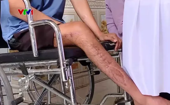 Phòng ngừa tai nạn lao động từ sớm, từ xa