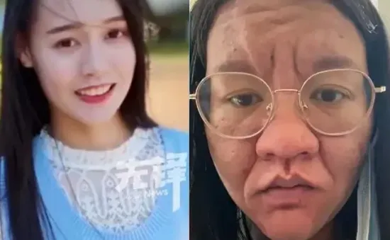 Mạng xã hội 'sốc' trước hình ảnh người phụ nữ xinh đẹp trở thành bà già khi mang thai