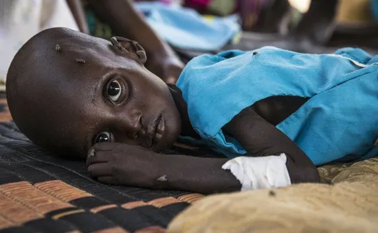 Trẻ em Sudan vật vã để sống sót qua ngày