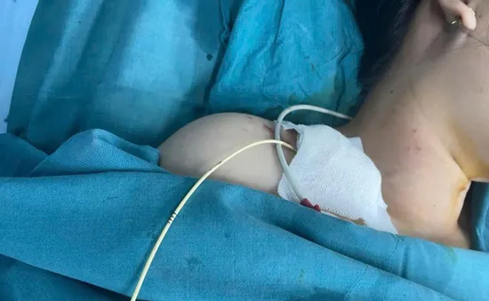 Viêm cơ tim cấp sau sinh: Sản phụ sống sót nhờ can thiệp kịp thời