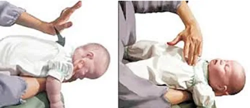 Cách xử lý khi trẻ bị hóc dị vật