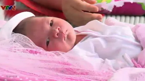 Những bệnh thường gặp ở trẻ sơ sinh