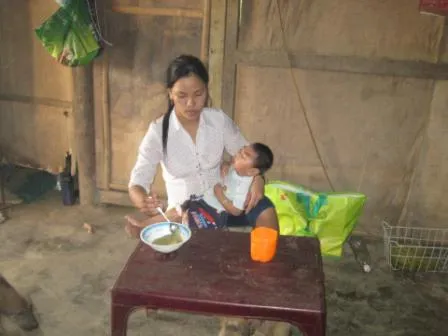Xót xa cậu bé 2 tuổi não nhỏ, sống như thực vật