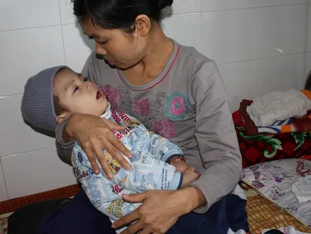 Bị rối loạn chuyển hóa bẩm sinh, tính mạng bé 2 tuổi vô cùng nguy kịch