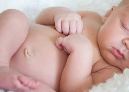 Bệnh lý về rốn trẻ sơ sinh 