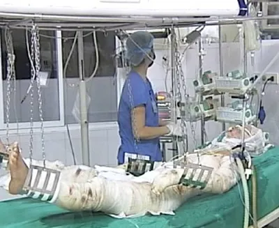 Vụ rơi máy bay Mi171: Hội chẩn liên viện cho các chiến sỹ bị thương