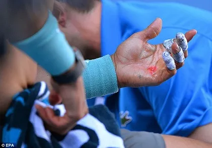 Australian Open: Tay Nadal bật máu trong trận thắng Dimitrov