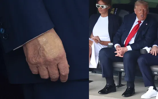 sức khỏe của ông Trump: Tin tức, Video, hình ảnh sức khỏe của ông Trump