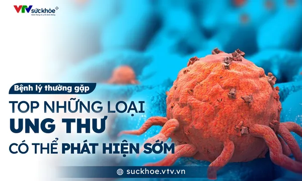 Top những loại ung thư có thể phát hiện sớm