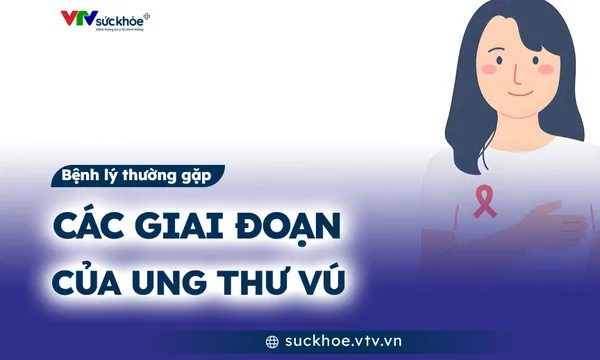 Các giai đoạn của ung thư vú