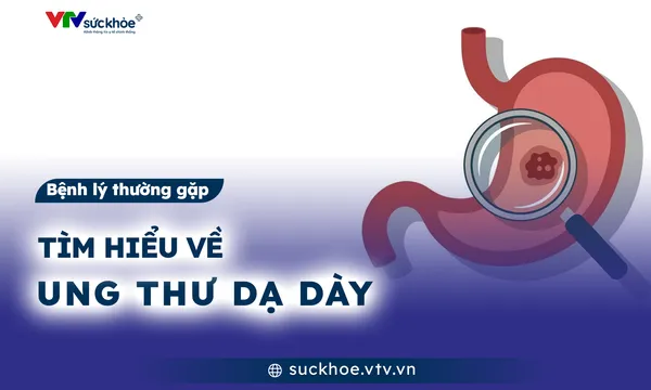 Tìm hiểu về ung thư dạ dày