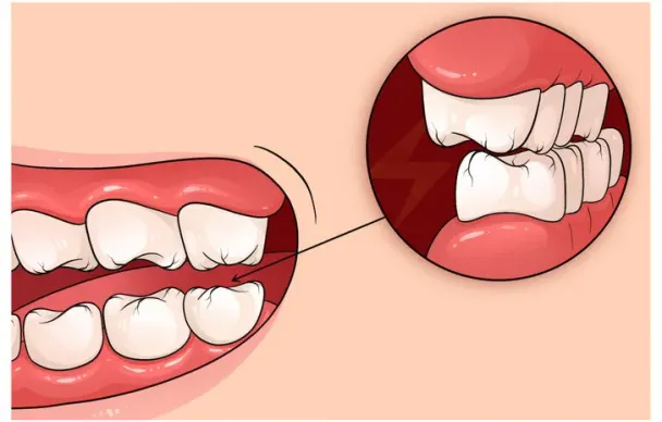 Căng thẳng âm thầm hủy hoại cơ thể bạn thế nào mà không ai ngờ tới?