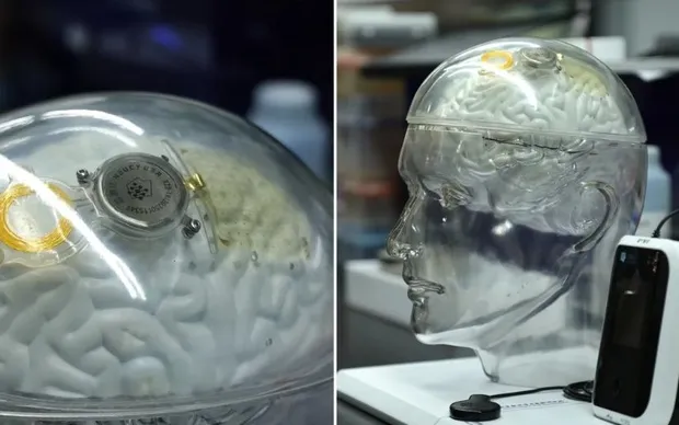 Cạnh tranh với Neuralink của Elon Musk, Trung Quốc "bắt kịp" Mỹ trong lĩnh vực cấy chip vào não người
