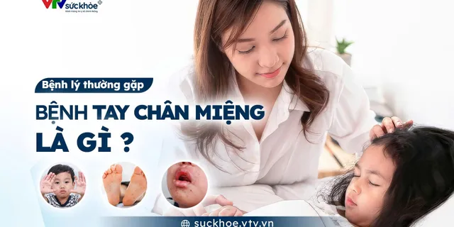 Bệnh Tay Chân Miệng là gì?