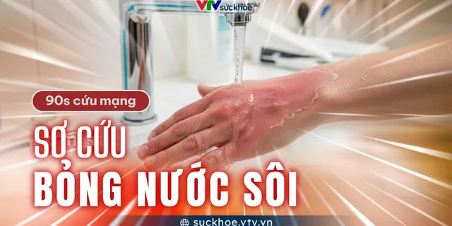 Sơ cứu bỏng nước sôi