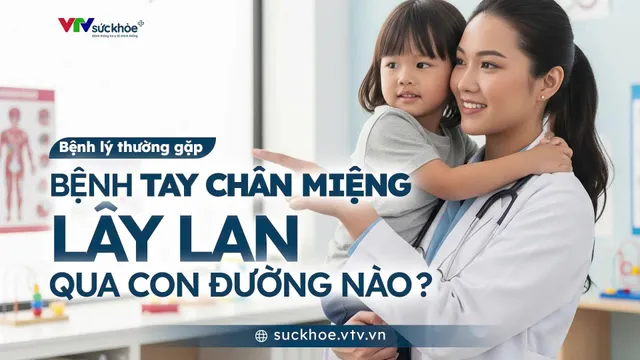 Tay chân miệng lây lan qua con đường nào