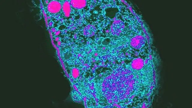 Cảnh báo bùng phát bệnh nhiễm ký sinh trùng toxoplasma tại Brazil