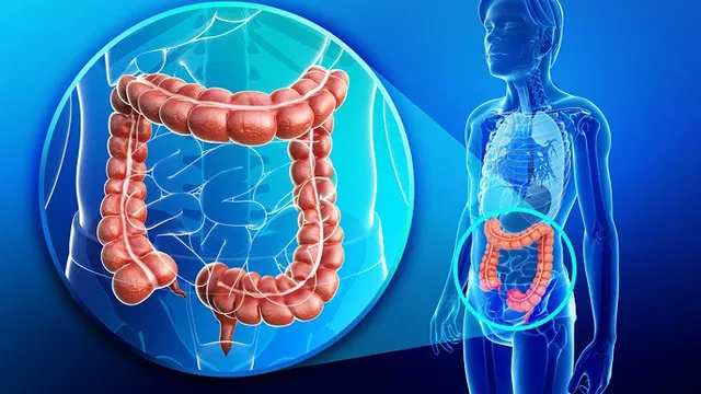 Sàng lọc sớm ung thư đại trực tràng