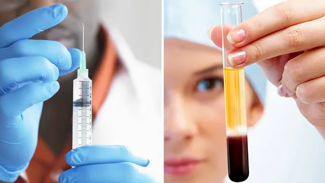 Làm đẹp bằng máu tự thân có an toàn?