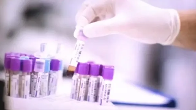 Xét nghiệm nước bọt có thể cách mạng hóa điều trị ung thư vú
