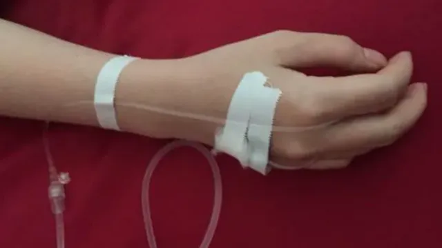 Sốt xuất huyết - Truyền dịch phải có chỉ định của bác sĩ