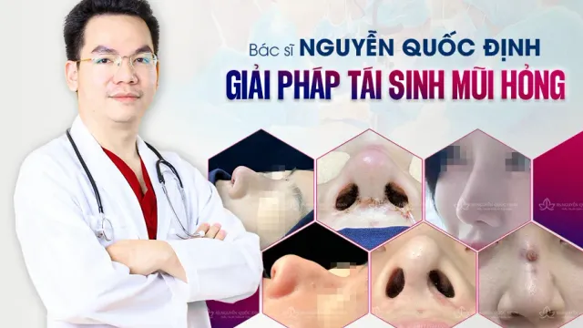 Bị hỏng mũi sau phẫu thuật thẩm mỹ, chị em cần làm gì?