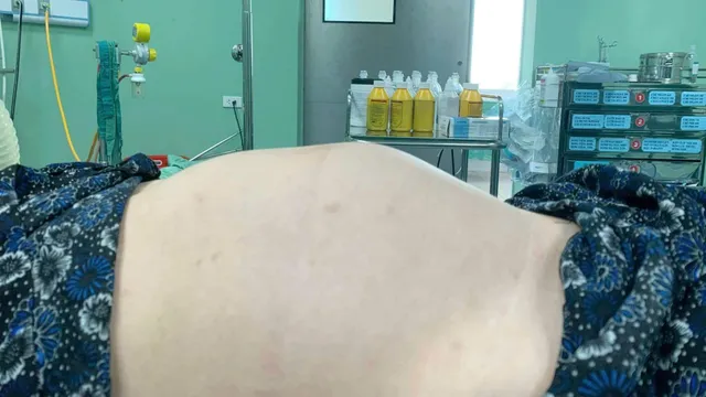 Các biến chứng nguy hiểm của thai trứng
