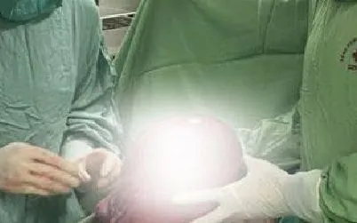 Phẫu thuật khối u tử cung phức tạp cho bệnh nhân 51 tuổi