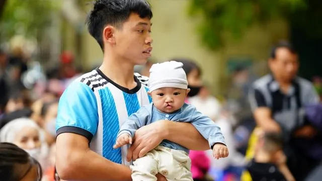 Gần 60 trẻ em được phẫu thuật khe hở môi - vòm miệng miễn phí