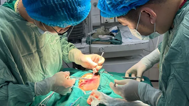 Bé trai bị chó nhà cắn nhiều vết thương vùng mặt