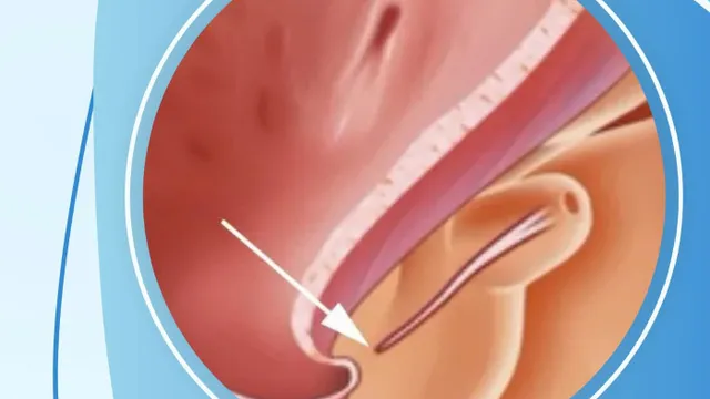 Lỗ tiểu thấp ở trẻ em: 5 dấu hiệu cha mẹ không nên bỏ qua