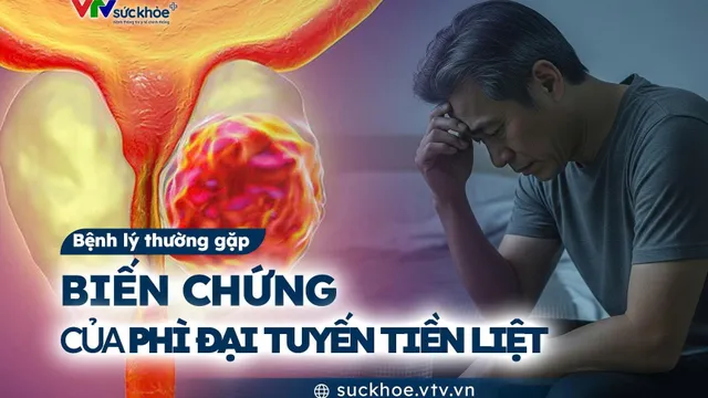Biến chứng của phì đại tuyến tiền liệt