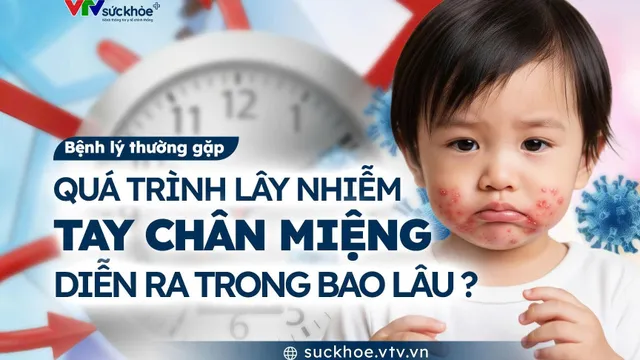Quá trình lây nhiễm tay chân miệng diễn ra trong bao lâu?