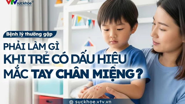 Phải làm gì khi trẻ có dấu hiệu mắc tay chân miệng?