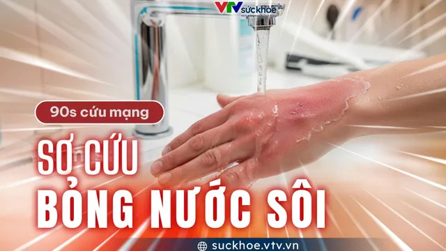 Sơ cứu bỏng nước sôi