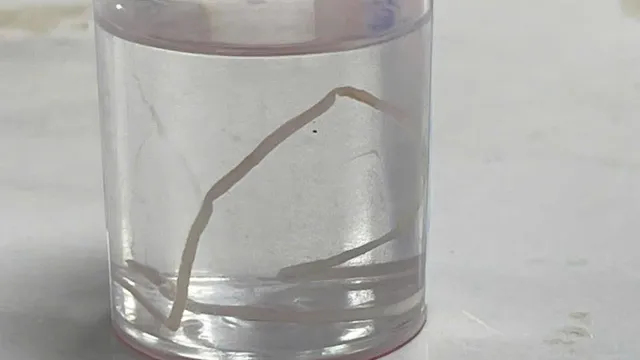 Bệnh giun rồng tái xuất tại Yên Bái: 16 ca mắc, nhiều ca do ăn gỏi cá và uống nước suối