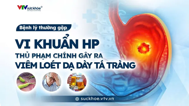 Vi khuẩn HP -  Thủ phạm chính gây viêm loét dạ dày tá tràng
