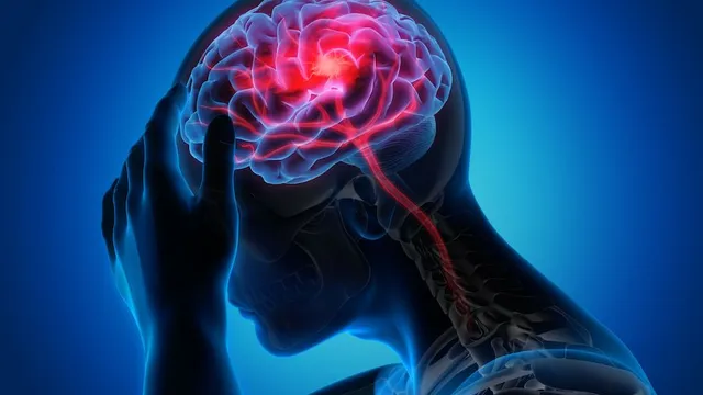 48 giờ 2 lần đột quỵ: 1 hành trình sống sót kỳ tích