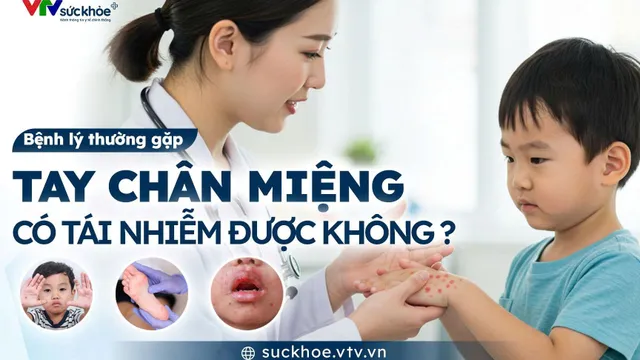 Tay chân miệng có tái nhiễm không?